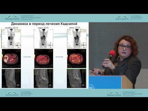 Видео: Клинический случай (пациента с РМЖ)