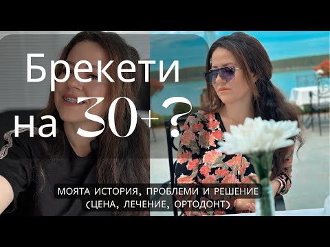 Видео: Брекети на 30+? Моята история, проблеми и решение (цена, лечение, ортодонт)