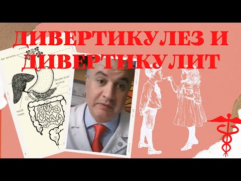 Видео: Дивертикулез толстого кишечника . Что не так с толстой кишкой?