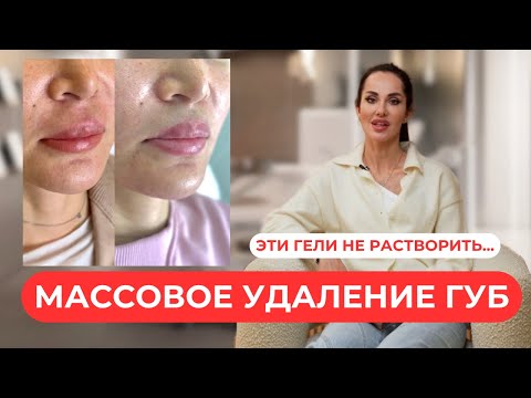 Видео: Правда про удаление биополимера из губ. Исправляем ошибки 2010х