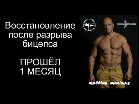Видео: Восстановление после разрыва бицепса. Прошёл  1 месяц.