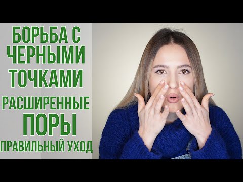 Видео: Уход за кожей склонной к черным точкам | Как избавиться от черных точек навсегда? | OiBeauty