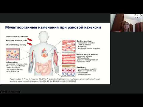 Видео: Возможности нутритивно-метаболической коррекции у онкологических пациентов с кахексией