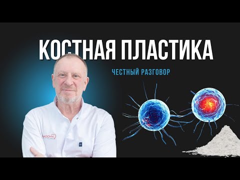 Видео: Имплантация с костной пластикой: честный разговор с хирургом #докторосадчий #стоматологиякиев