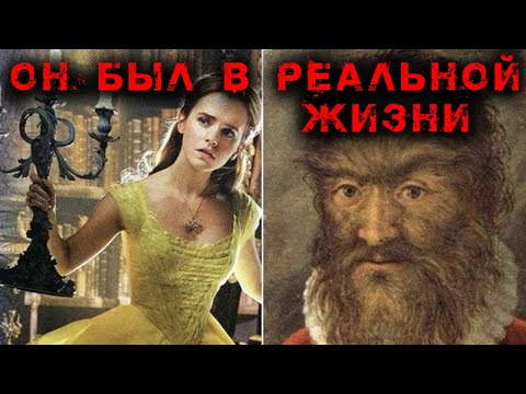 Видео: Реальный случай Красавицы и чудовища | Записки Ричарда