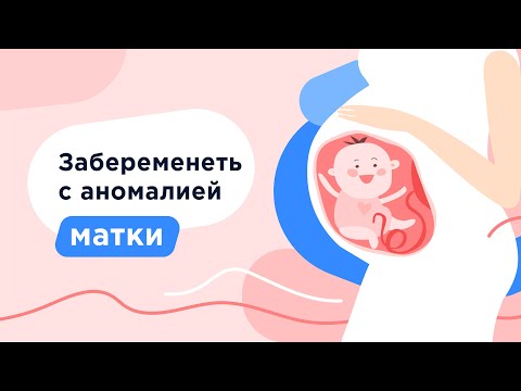 Видео: Двурогая матка | Седловидная матка | Однорогая матка | Перегородчатая матка | Гипоплазия матки