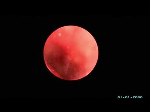 Видео: к оскар, риноскопия + лтбс