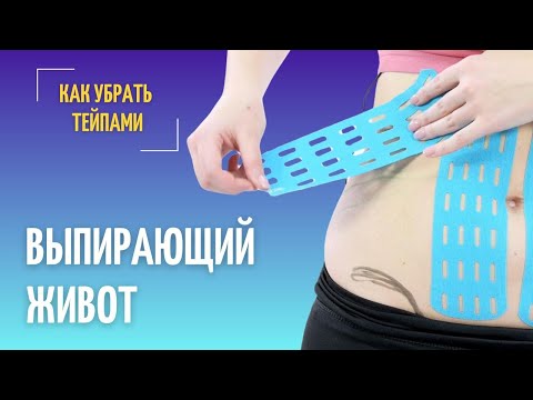 Видео: Как убрать тейпами выпирающий живот? Простой и легкий способ!