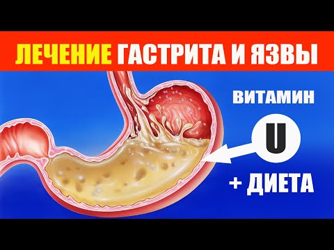Видео: Этот Витамин избавит вас от Гастрита и Язвы