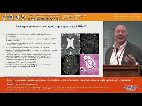 Видео: Щукин Иван Александрович Хроническая цереброваскулярная патология патогенетическая терапия с позиц