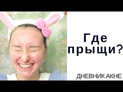 Видео: Дневник АКНЕкутана 13. Почему нельзя останавливаться?