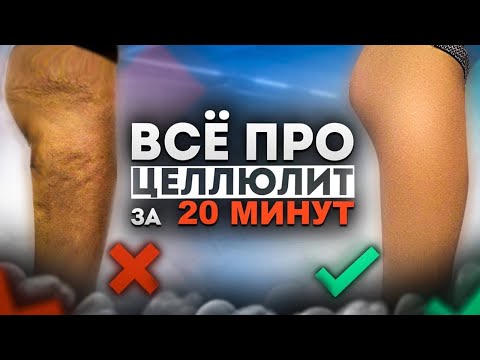 Видео: Всё про ЦЕЛЛЮЛИТ за 20 МИНУТ | Причины возникновения и методы борьбы, которые РЕАЛЬНО работают