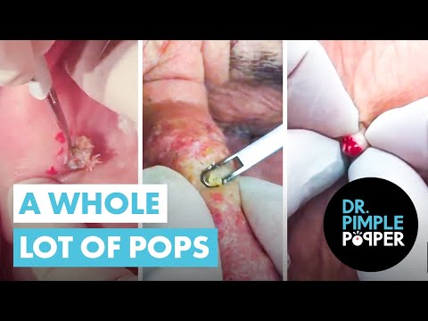 Видео: Целая куча хлопков