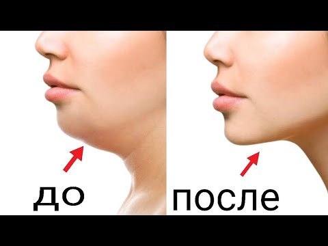 Видео: 2 ДЕЙСТВЕННЫХ УПРАЖНЕНИЯ, ЧТОБЫ ИЗБАВИТЬСЯ ОТ ВТОРОГО ПОДБОРОДКА | Доктор Вивек