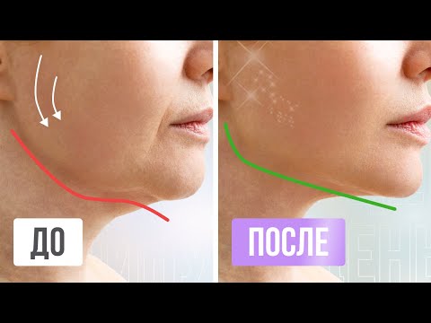 Видео: Подтягиваем ОБВИСШИЕ ЩЁКИ за 20 минут | Простые упражнения для поднятия щек в домашних условиях