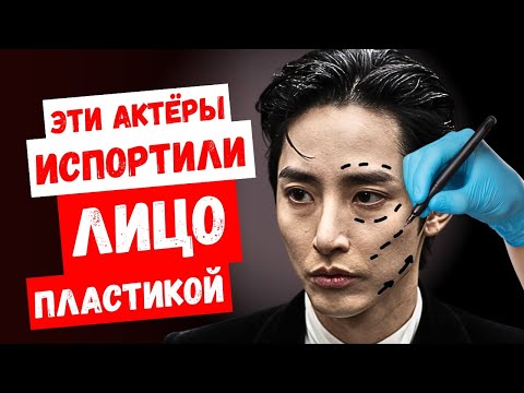 Видео: Теперь их не узнать! Корейские актёры, которые не смогли сохранить свою природную красоту