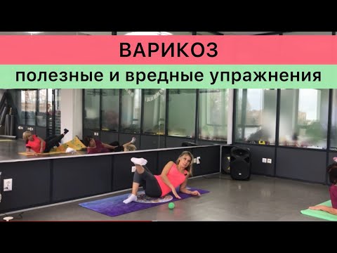 Видео: Варикоз.Полезные и вредные упражнения.
