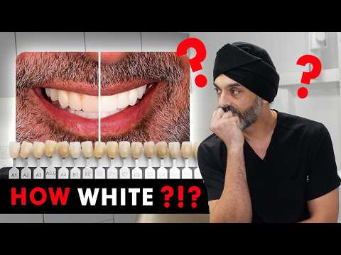 Видео: Слишком белый или идеальный? Как выбрать идеальный оттенок зубов