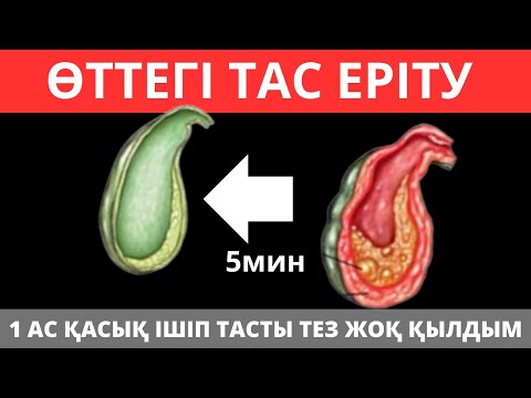 Видео: ӨТТЕГІ ТАСТЫ ТЕЗ ЕРІТУ ЖОЛЫ ОЛ. өт тас ауруы, өттегі тас, өт толса не істеу керек.