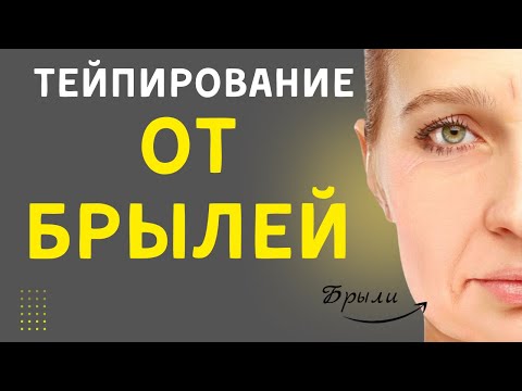 Видео: Тейпирование от брылей