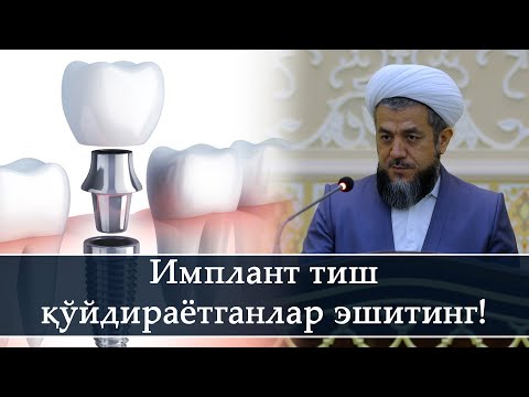 Видео: Имплант тиш қўйдираётганлар эшитсин