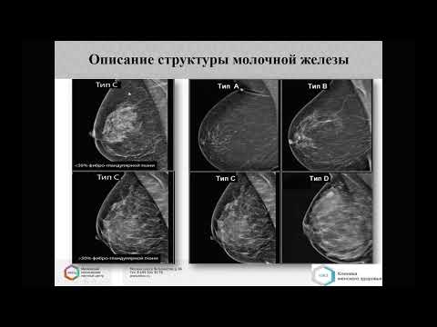 Видео: МАММОГРАФИЯ Лекция «Система оценки BI RADS, использование в повседневной практике»