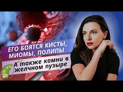 Видео: Его боятся кисты, миомы, полипы, а также камни в желчном пузыре.