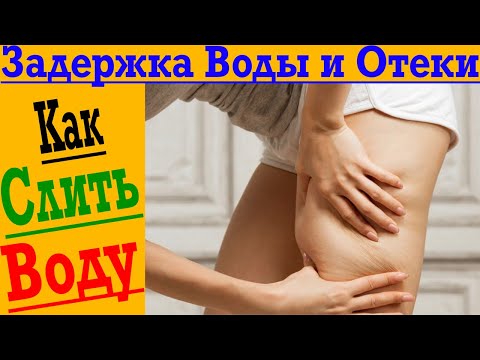 Видео: Как быстро слить воду из организма?! Отеки и задержка жидкости!