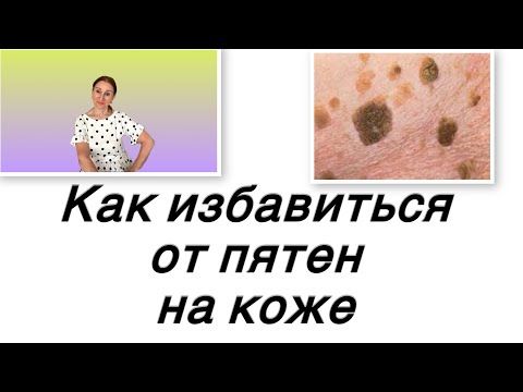 Видео: 🟢 ПЯТНA и НАРОСТЫ … как избавиться… 100% результат