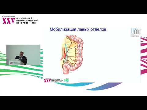 Видео: Несостоятельность колоректального анастомоза: причины, профилактика, лечение и последствия
