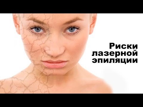 Видео: Осложнения лазерной эпиляции волос! Основные ошибки проведения процедуры.