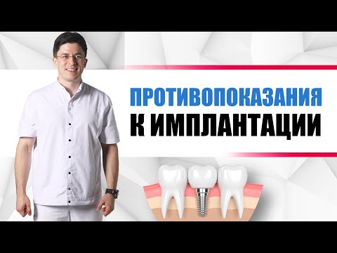 Видео: Противопоказания к имплантации = КОГДА ИМПЛАНТЫ СТАВИТЬ ЗАПРЕЩЕНО???