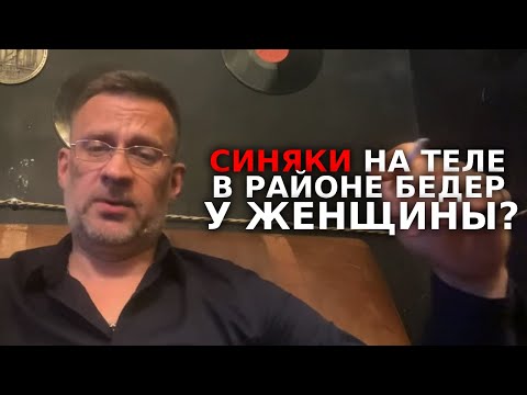 Видео: Синяки на теле в районе бедер ,зачем женщины изменяют ?
