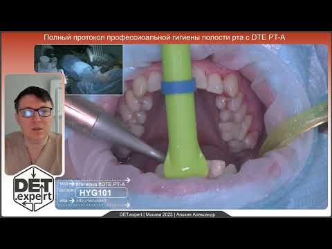 Видео: Полный протокол профессиональной гигиены полости рта с #DTE #PT-A #DET.expert #HYG101  Dual 4K