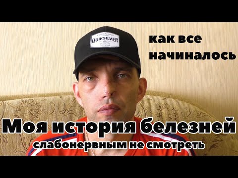 Видео: Моя история болезней, слабонервным не смотреть ( не слушать )