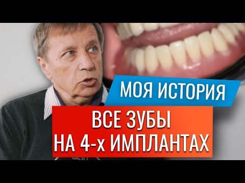 Видео: Видео отзыв, All on 4 альтернатива, протезирование всех зубов до/после. Стоматология в Ставрополе.