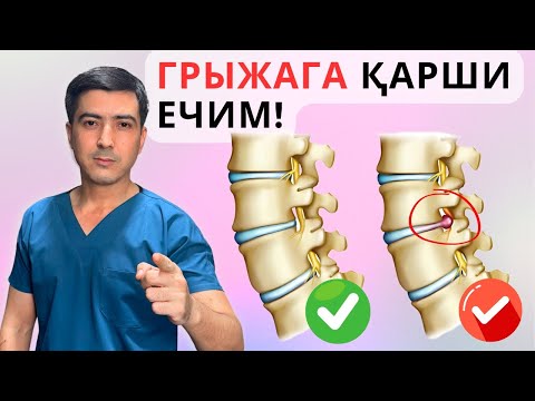 Видео: ГРЫЖА ДАВОЛАНАДИ! МУТАХАССИСЛАРДАН ЭКСКЛЮЗИВ МАСЛАҲАТЛАР! #кинезиология #physiotherapy #грыжа
