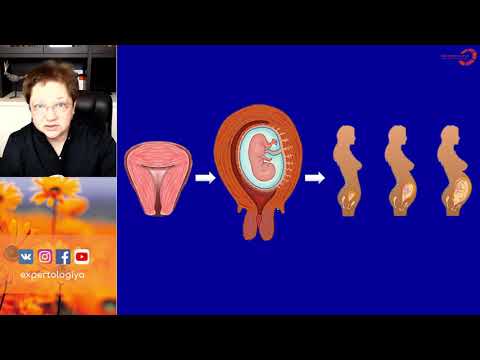 Видео: Экспертология | Гипертонус матки при беременности