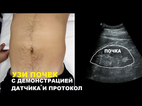 Видео: Пишем ПРОТОКОЛ УЗИ почек ВМЕСТЕ