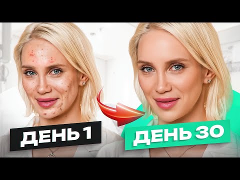 Видео: У кожи есть иммунитет! 5 шагов, чтобы его ПОВЫСИТЬ до максимума
