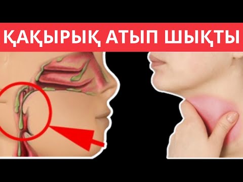 Видео: Қақырық ТАМАҚТАН шықса АСҚАЗАНДЫ ТЕКСЕРТ. Қақырықты қалай түсіруге болады