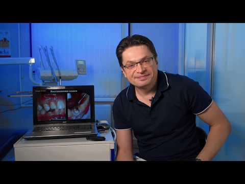 Видео: Функциональная окклюзия - контроль движений и контакты в динамике