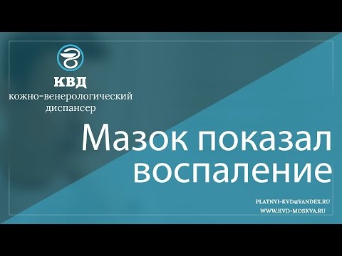 Видео: 218  Мазок показал воспаление