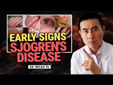 Видео: Ранние признаки болезни Шегрена