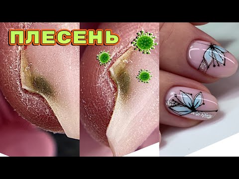 Видео: ПЛЕСЕНЬ под ногтем 🙁 Как убрать?  Розыгрыш гелей / Маникюр на клиенте