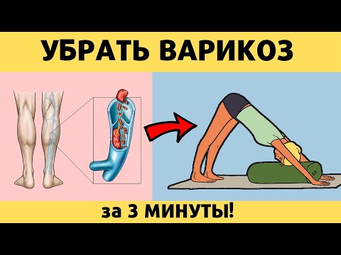 Видео: 3 УПРАЖНЕНИЯ от ВАРИКОЗА, УСТАЛОСТИ НОГ и БОЛИ В ПОЯСНИЦЕ