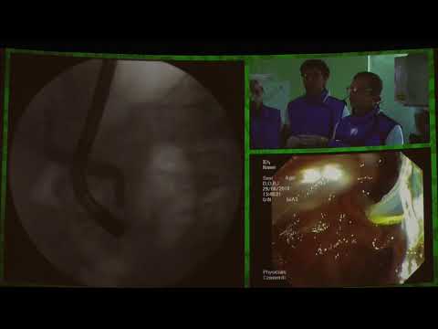 Видео: 16Live Бурдюков МС Опухоль дистального отд холедоха ЭУС ЭРХПГ ЭПСТ дренирование холедоха