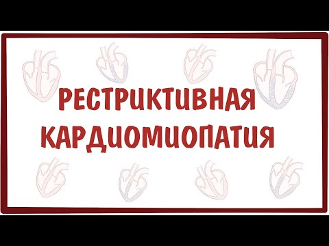 Видео: Рестриктивная кардиомиопатия — причины, симптомы, патогенез, диагностика, лечение