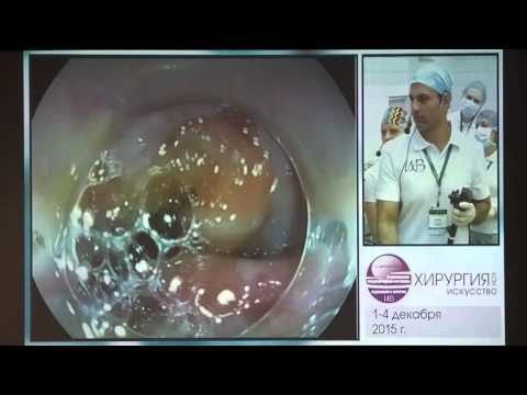 Видео: КС 01   Rehan Haidry   Кишечная метаплазия верхней трети пищевода  АПК