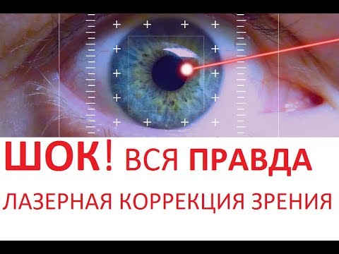 Видео: ШОК!! Смотреть ВСЕМ! ЛАЗЕРНАЯ КОРРЕКЦИЯ ЗРЕНИЯ - отзывы минусы